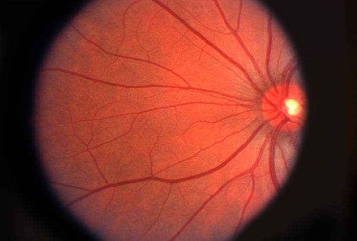 What is Retina in the Eye?